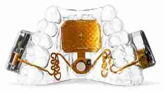Transparent jaw model displaying a dental implant with orange electronic components and wiring.